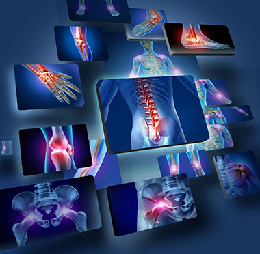 Osteoarthritis-2 image مهندسی پزشکی